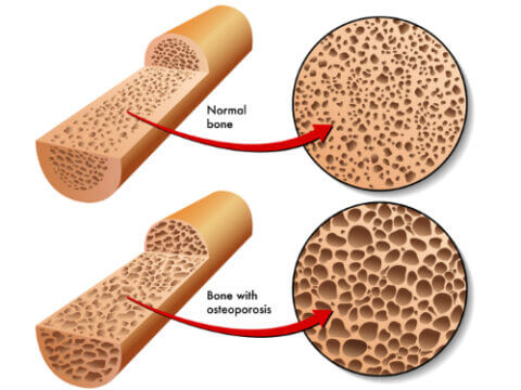 Home - Dexa Protection